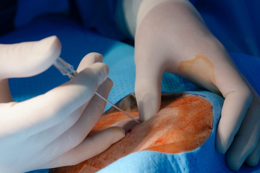 Bác sĩ thực hành can thiệp hút huyết khối trên động vật | Animal Lab Workshop