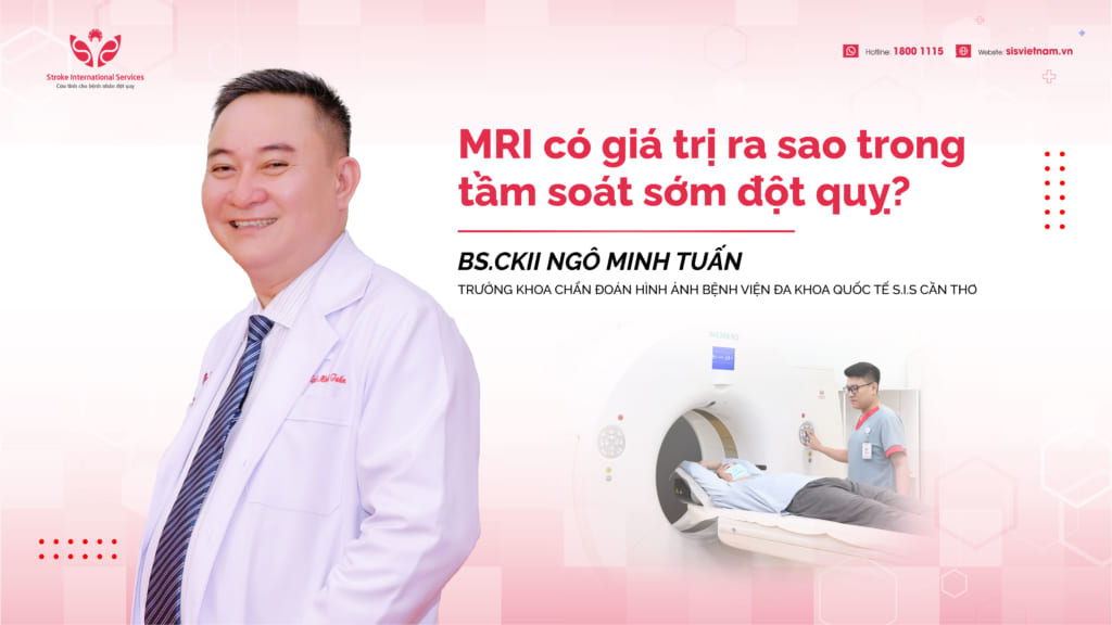 MRI có giá trị ra sao trong tầm soát sớm đột quỵ?