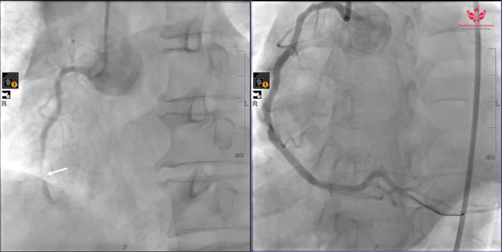 Hai lần “chết hụt”, người đàn ông được cứu sống kỳ diệu