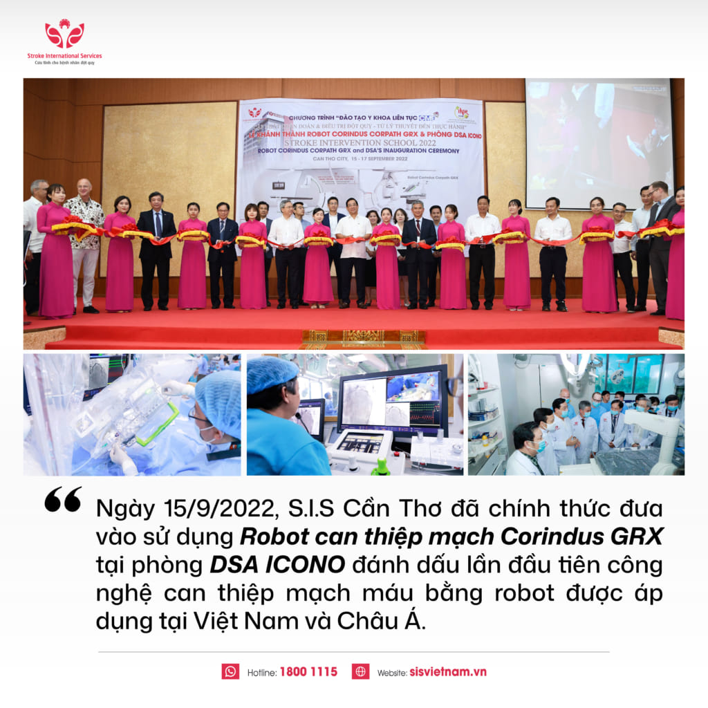 S.I.S ứng dụng “mắt thần” can thiệp DSA Artis Icono trong điều trị bệnh mạch máu