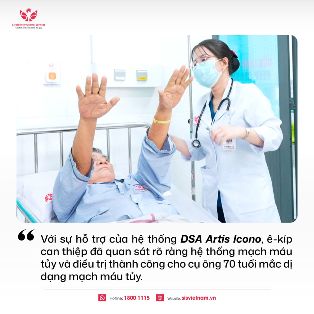 S.I.S ứng dụng “mắt thần” can thiệp DSA Artis Icono trong điều trị bệnh mạch máu