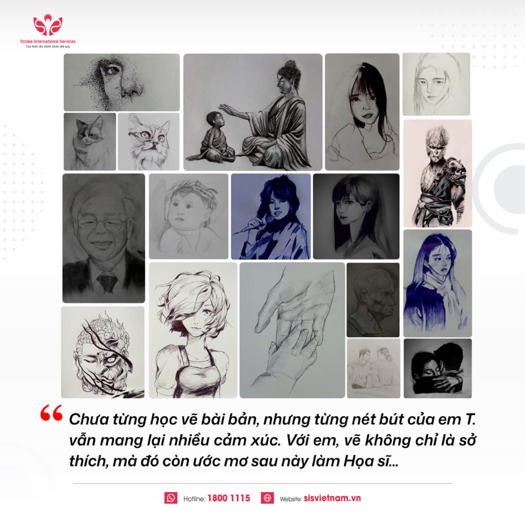 Giữ lại giấc mơ làm họa sĩ cho nam sinh lớp 8 sau cơn xuất huyết não nguy kịch