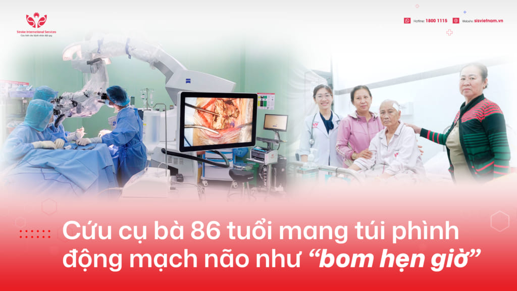 Cứu cụ bà 86 tuổi mang túi phình động mạch não như “bom hẹn giờ”