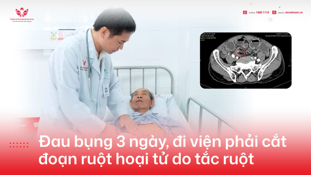 Đau bụng 3 ngày, đi viện phải cắt đoạn ruột hoại tử do tắc ruột