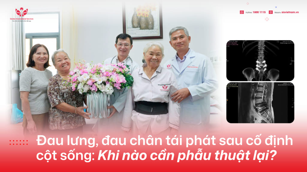 S.I.S phẫu thuật nội soi xử lý tổn thương tầng kế cận sau cố định cột sống