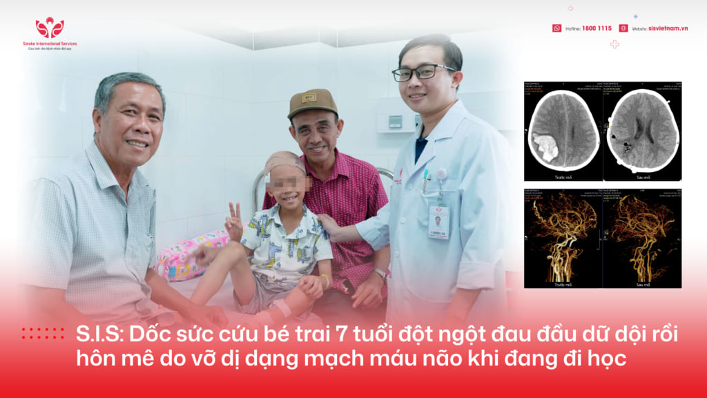 Đang học, bé trai đột ngột đau đầu dữ dội rồi hôn mê do vỡ dị dạng mạch máu não
